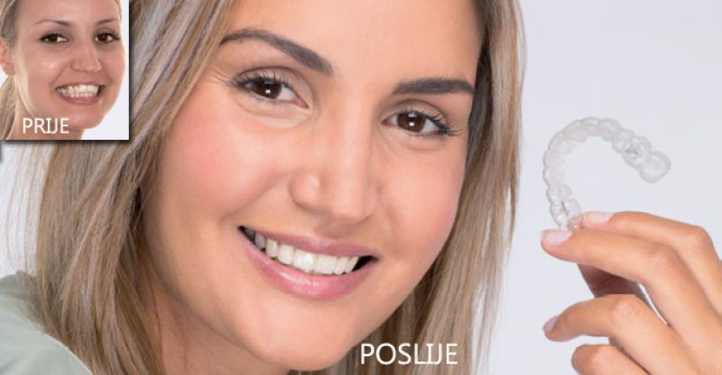 OBLIKUJTE NOVI OSMIJEH Invisalign terapijom u zagrebačkoj poliklinici IMED!